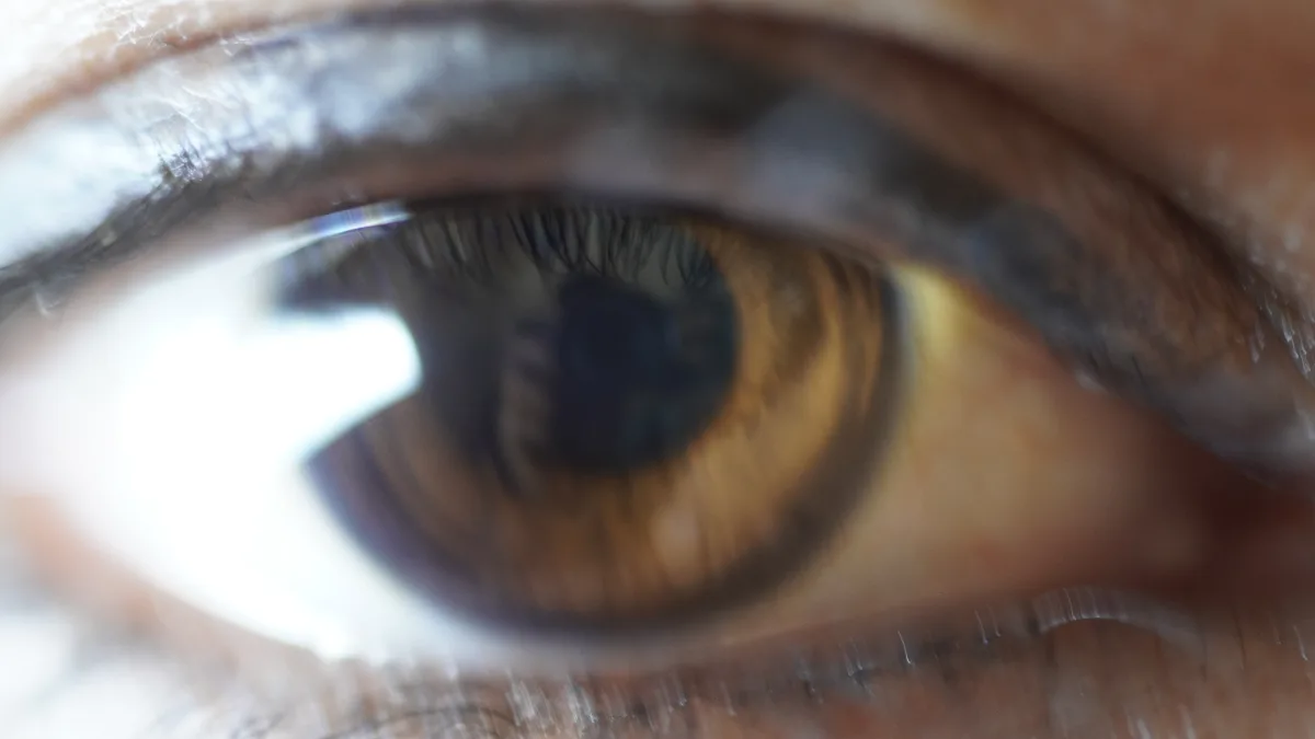Eye